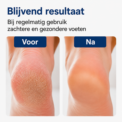 Solevia™ – Silliconen Voetenspa
