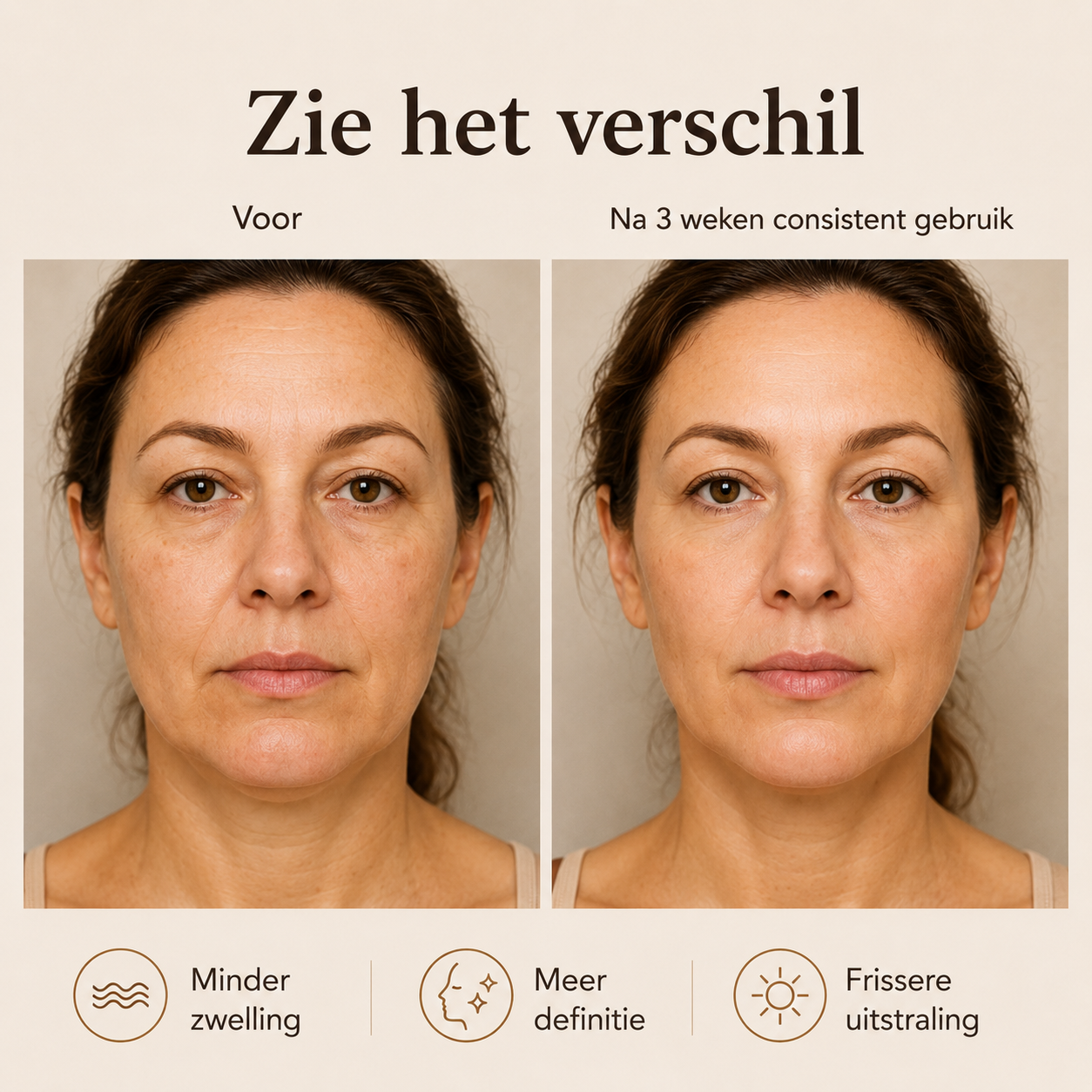 Lymphèra™ - lymfedrainage borstel