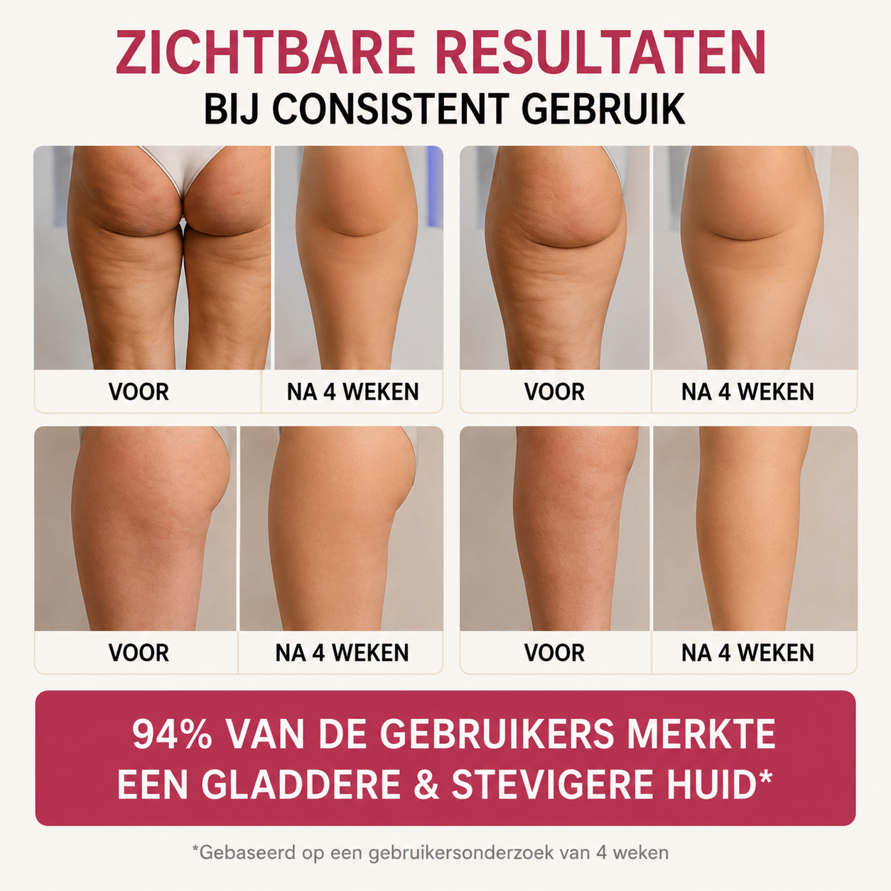 Celluvia™ - Cellulit massageapparat