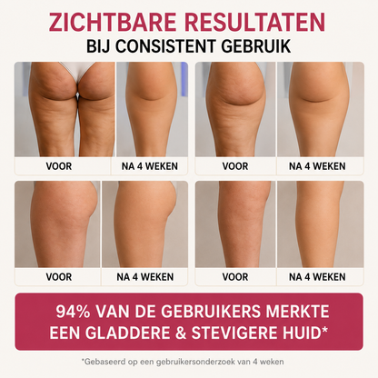 Celluvia™ - Cellulit massageapparat