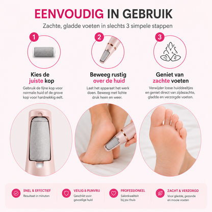 Veloura™ Elektrische Eeltverwijderaar
