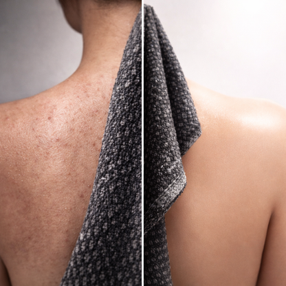 Exfoliax™ - antibacteriële douchehanddoek